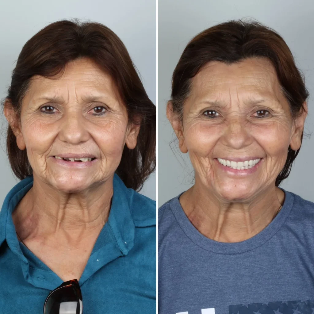 caso-clinico-dentista-campo-grande-ms