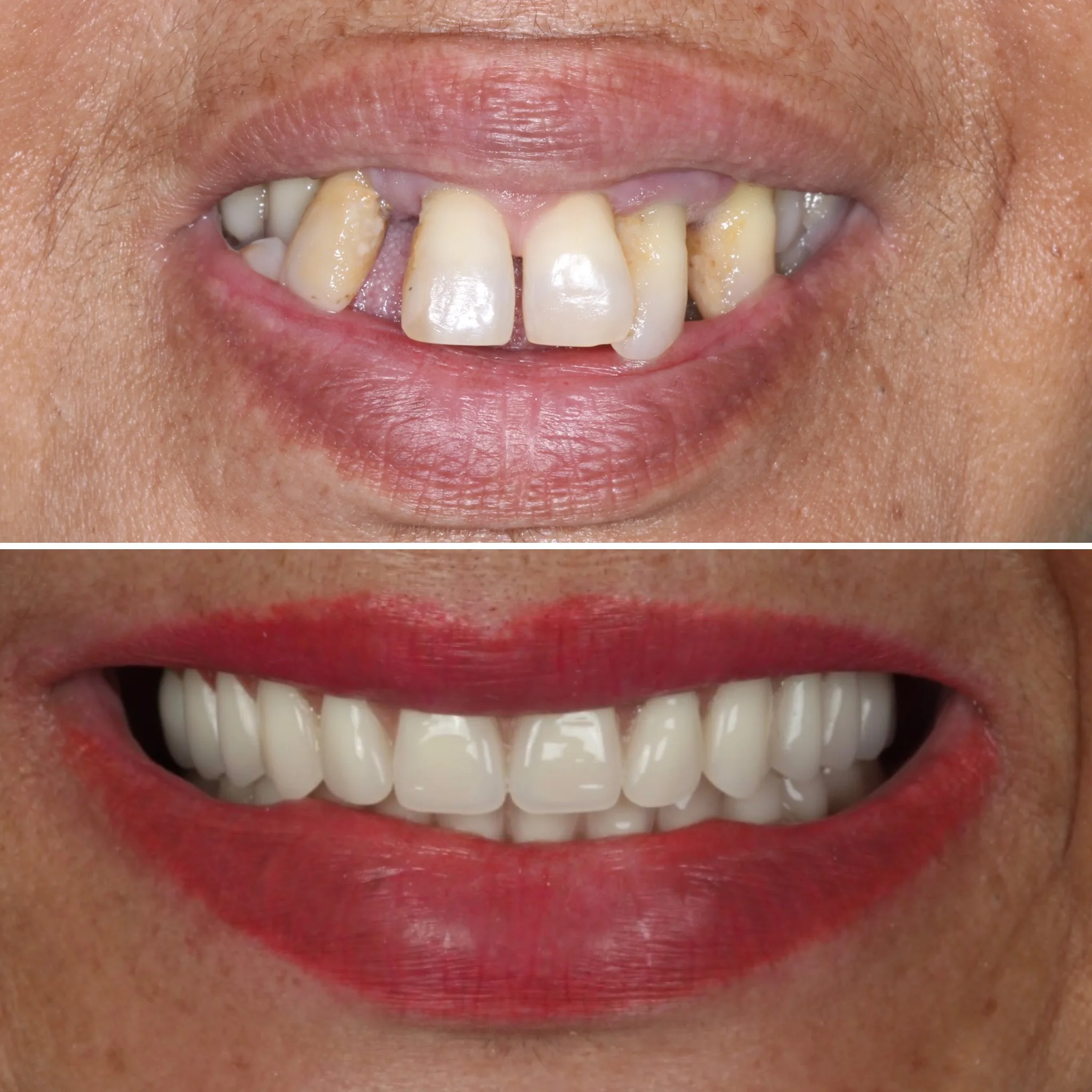 clinica-de-implante-dentario-campo-grande-ms
