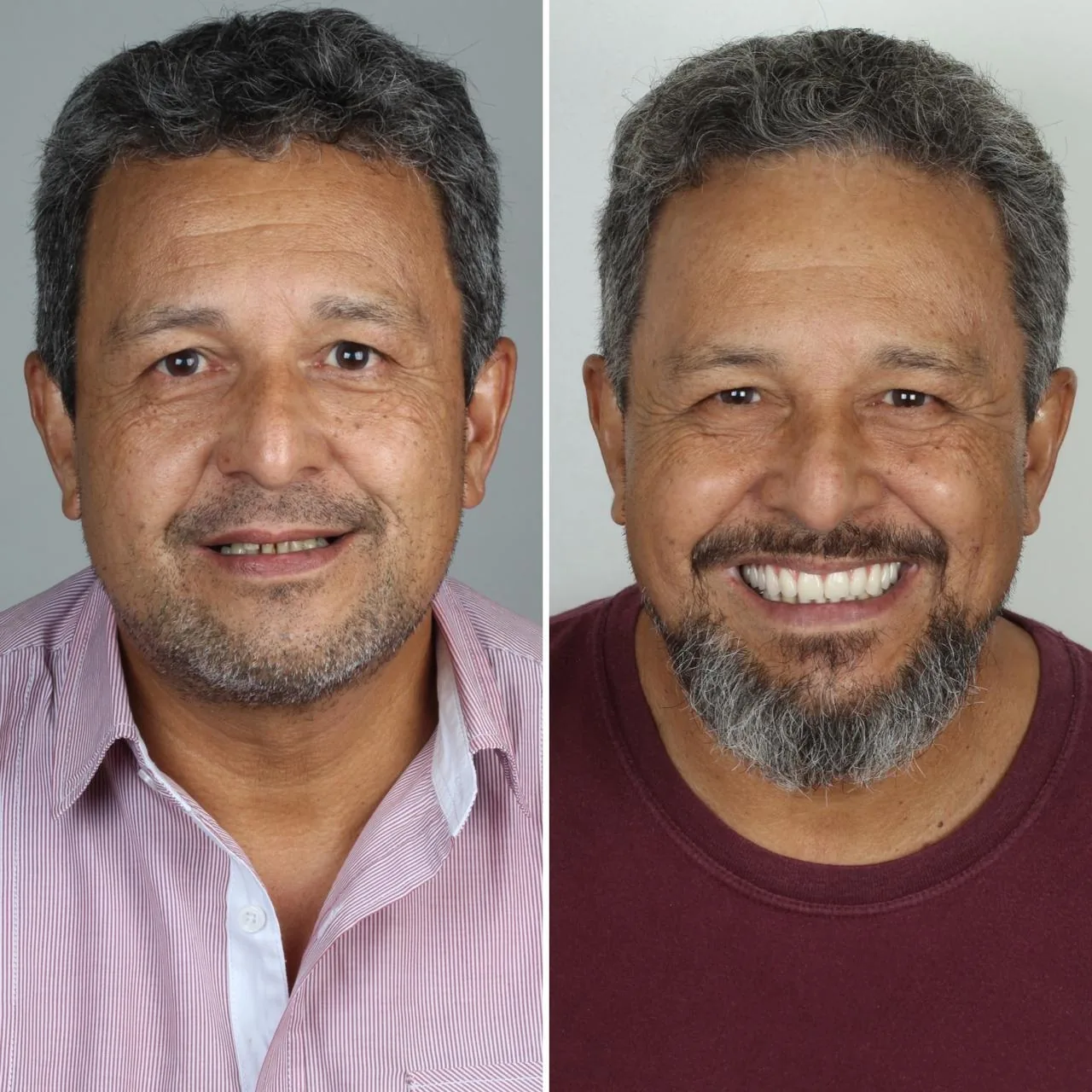 clinicas-dentarias-em-campo-grande-ms
