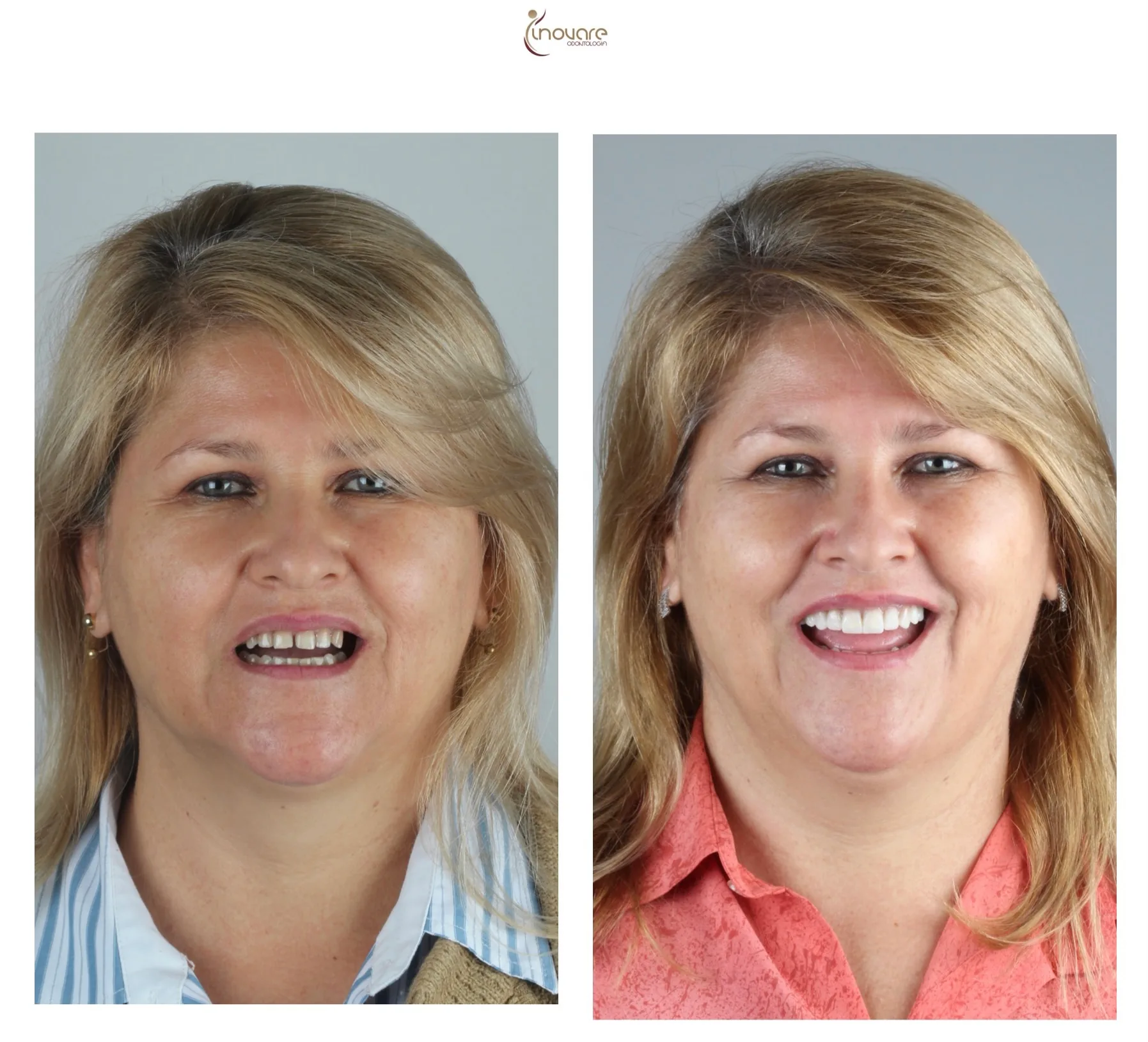 dentista-campo-grande-ms-centro