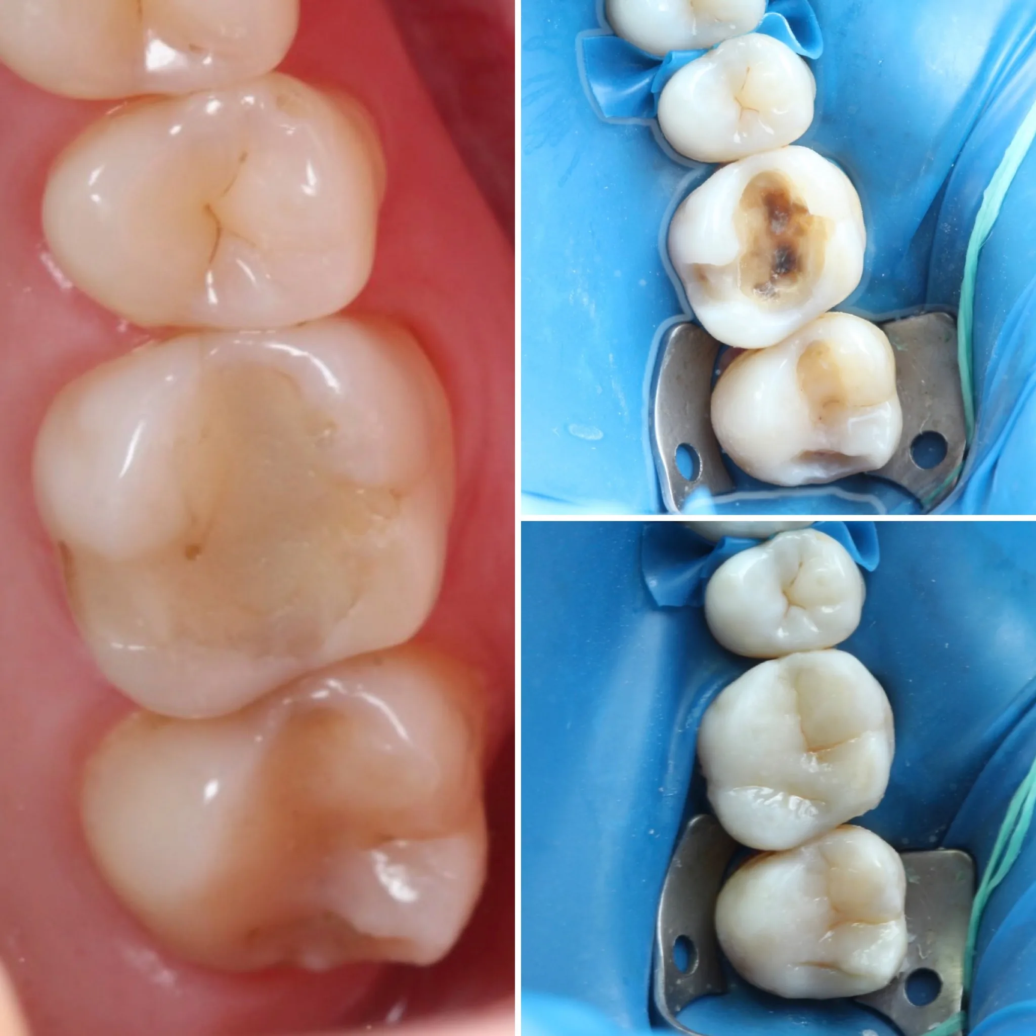 dentista-clinico-geral-campo-grande-ms