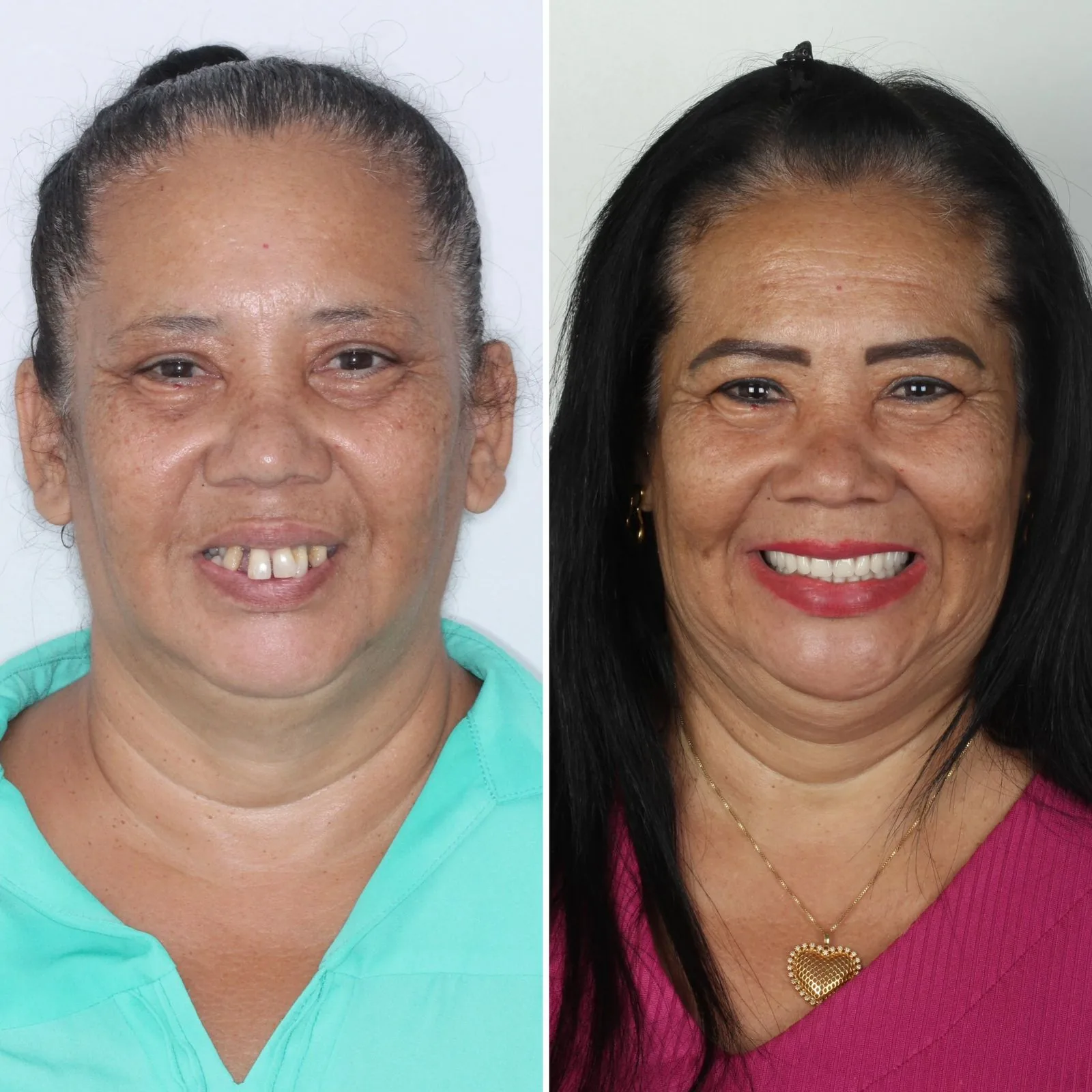 dentista-em-campo-grande-ms