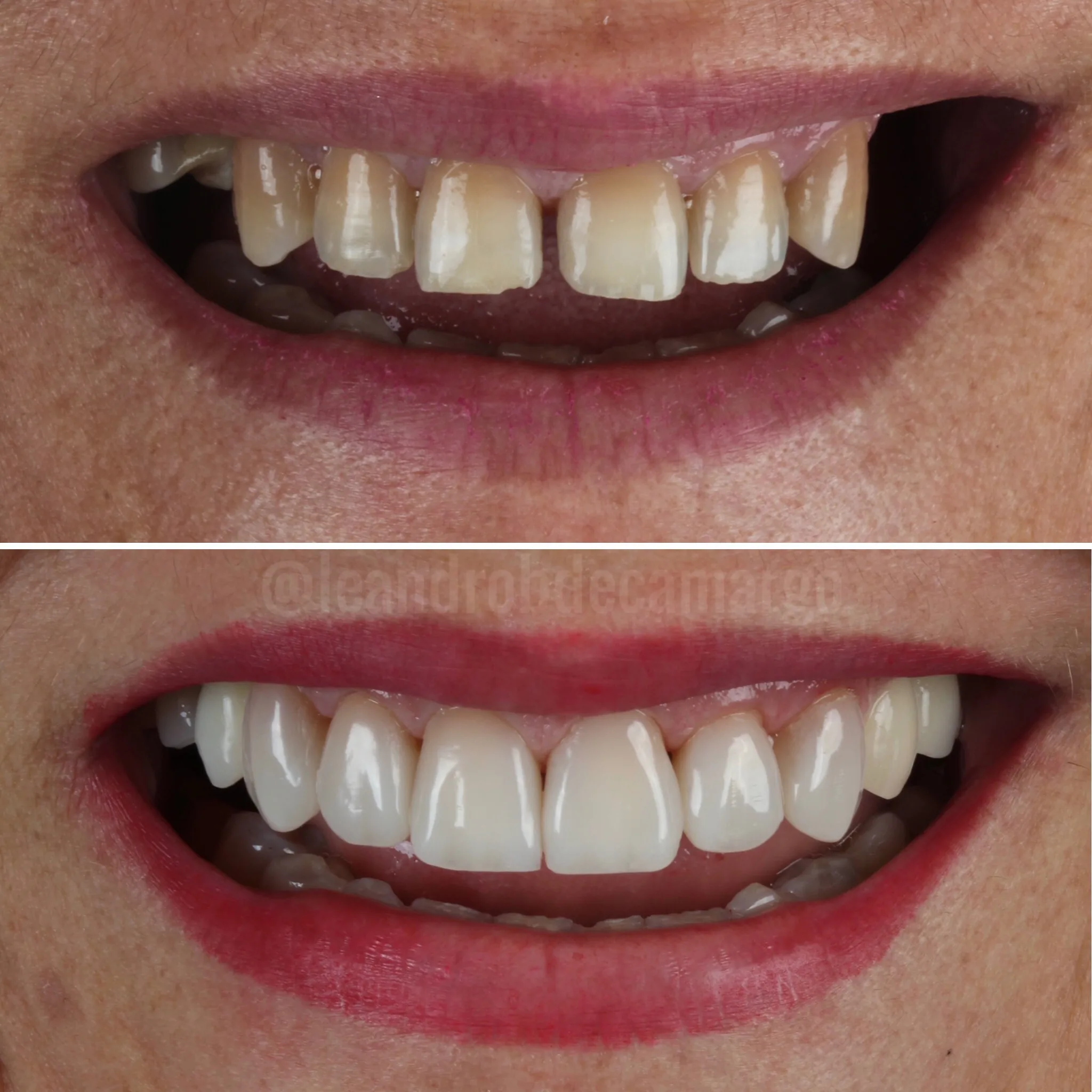 dentista-especialista-em-reabilitacao-campo-grande-ms