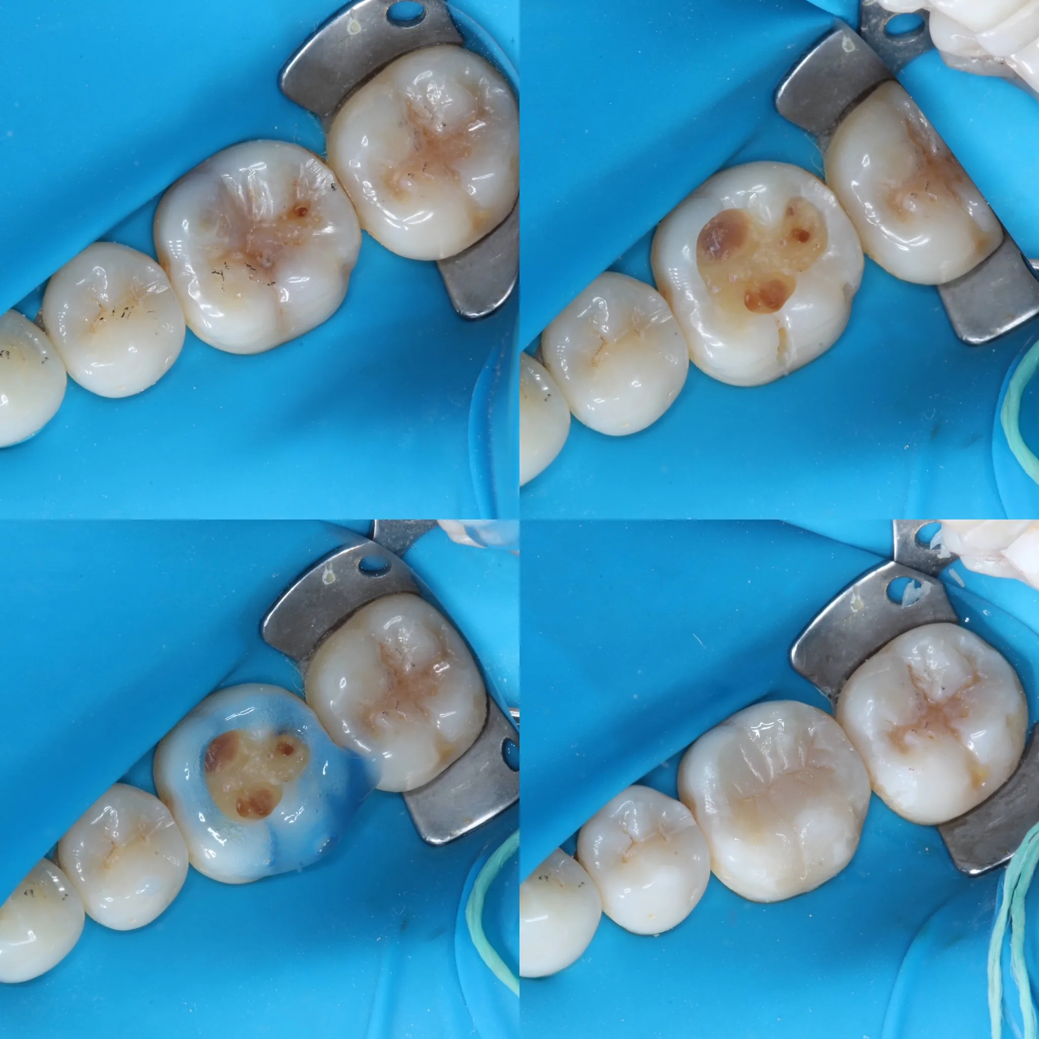 endodontista-campo-grande-ms