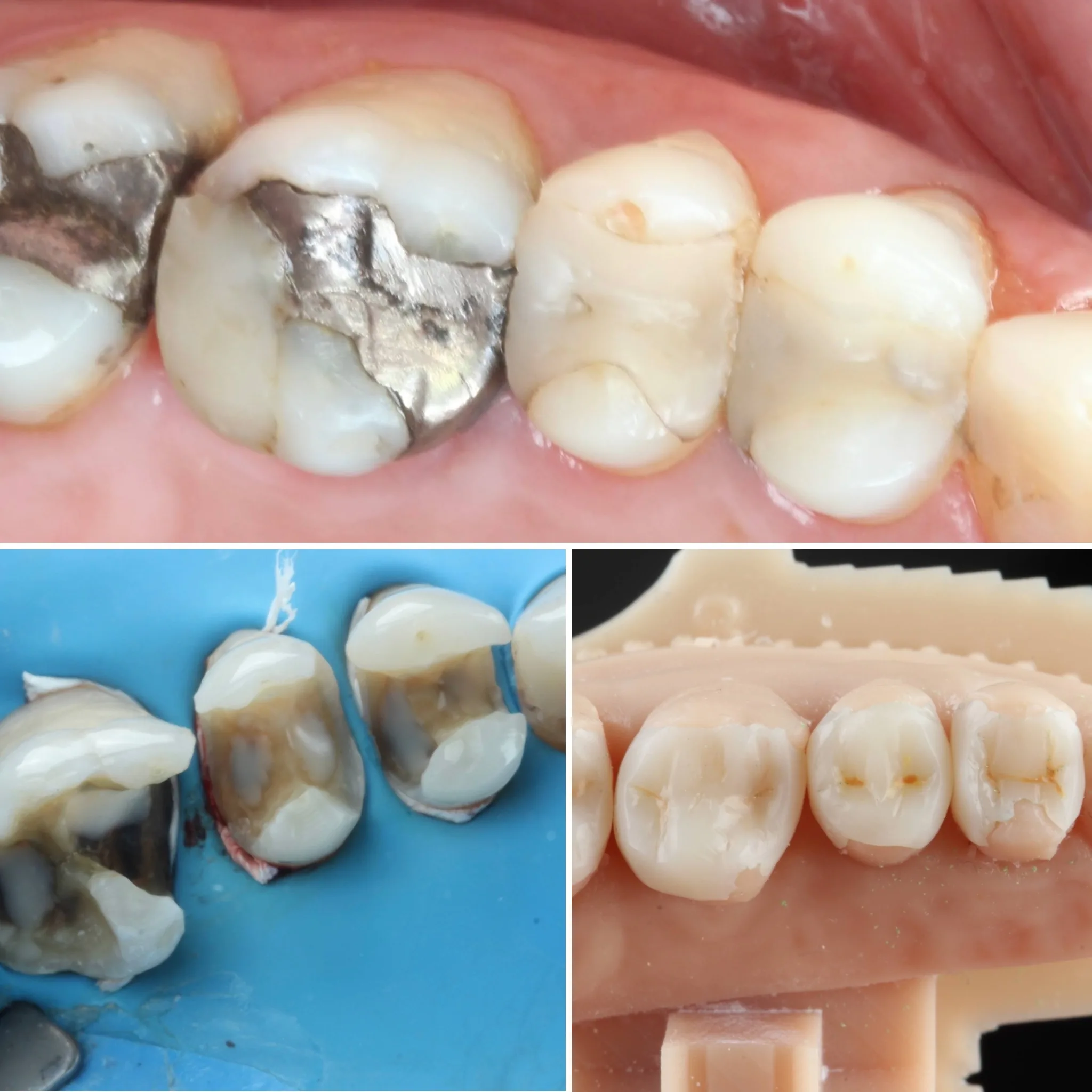 limpeza-de-dente-campo-grande-ms
