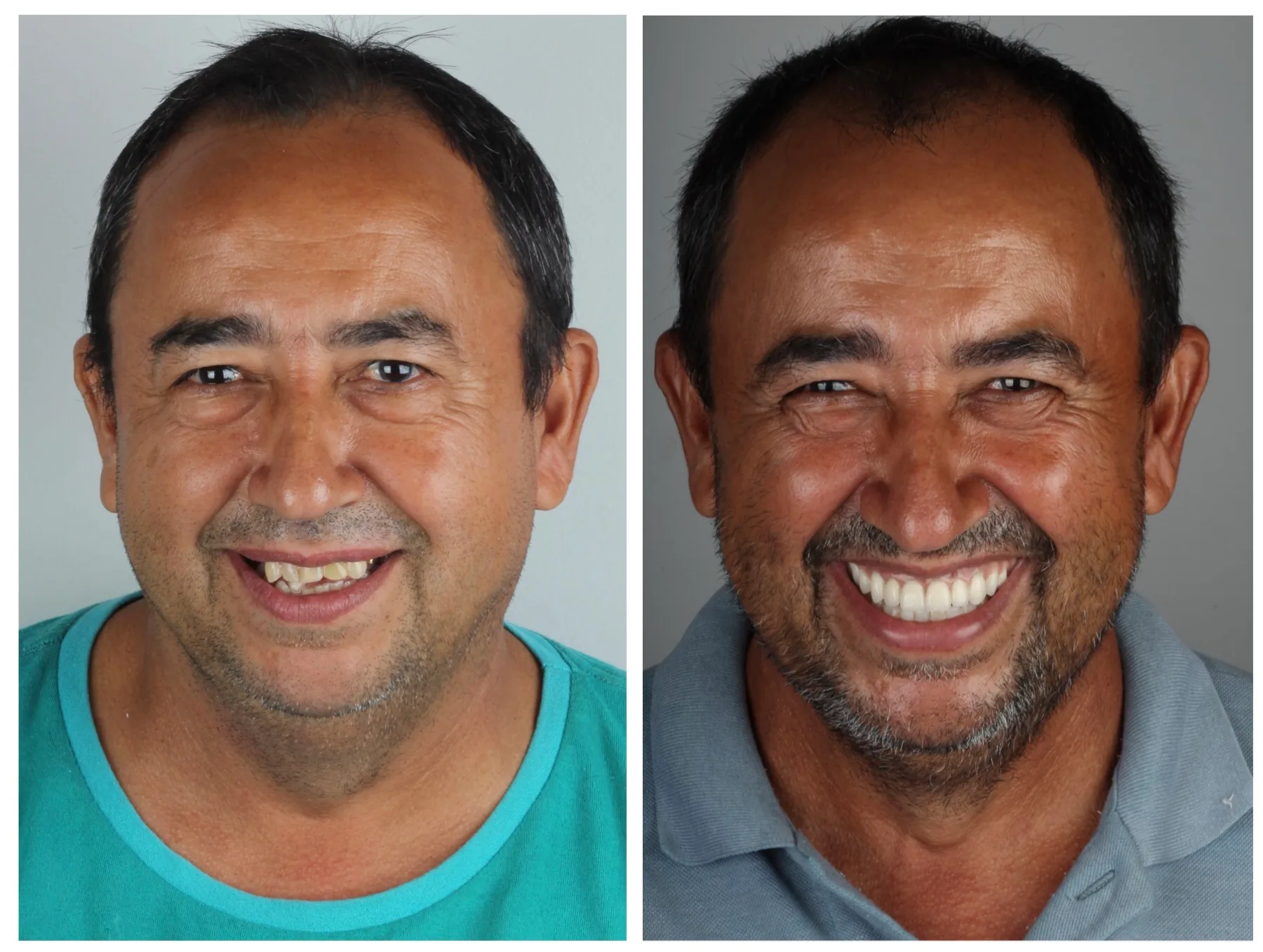 melhor-dentista-de-campo-grande-ms