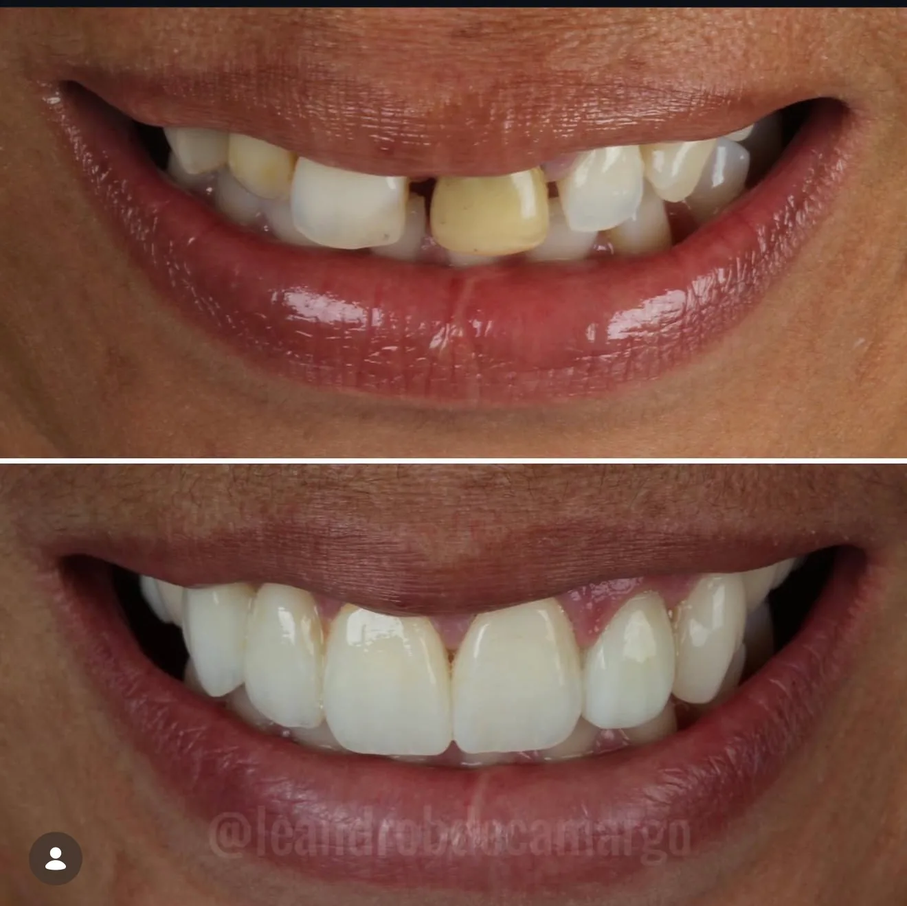 reabilitacao-estetica-campo-grande-ms