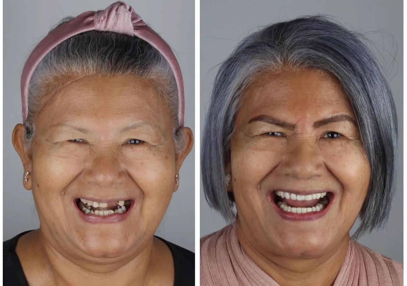sorriso-novo-dentista-campo-grande-ms