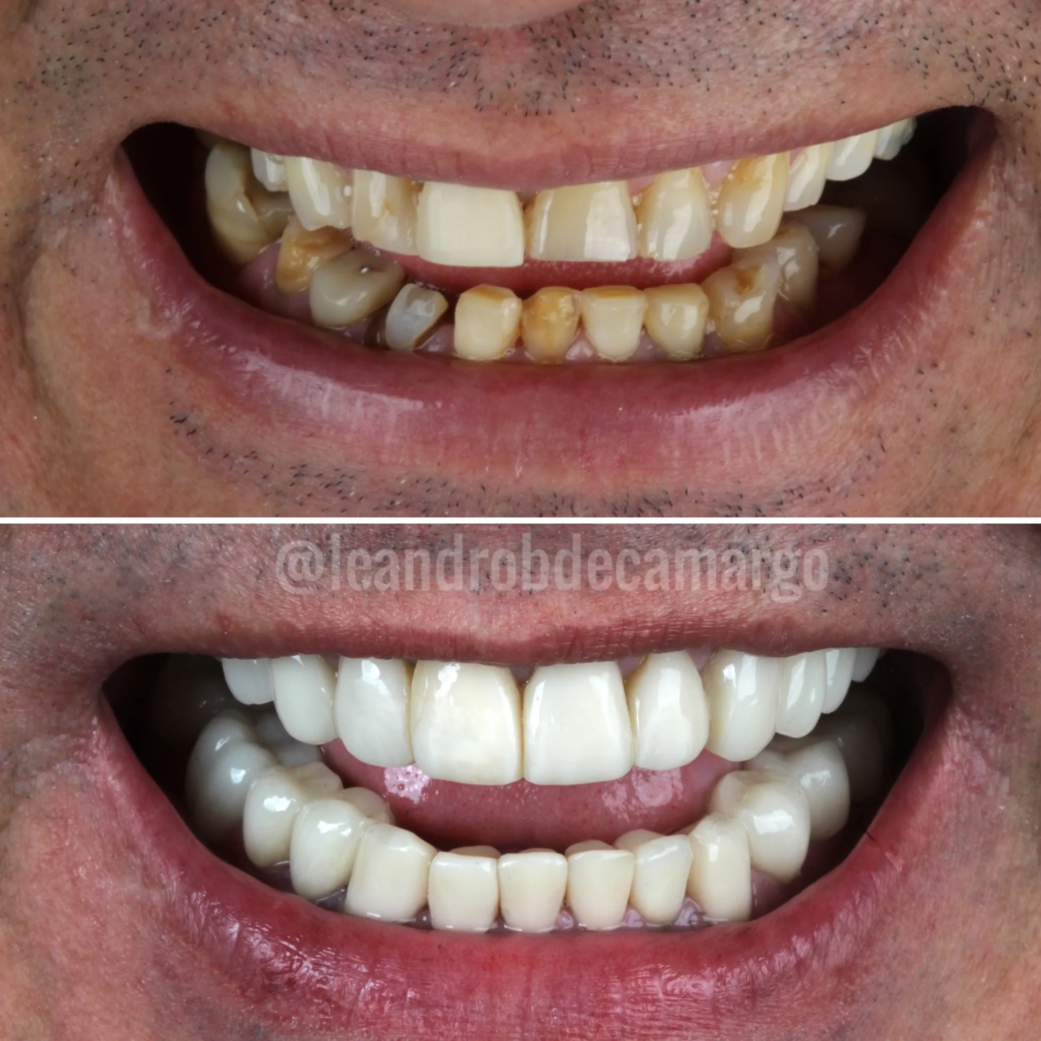 tratamento-dentario-completo-campo-grande-ms