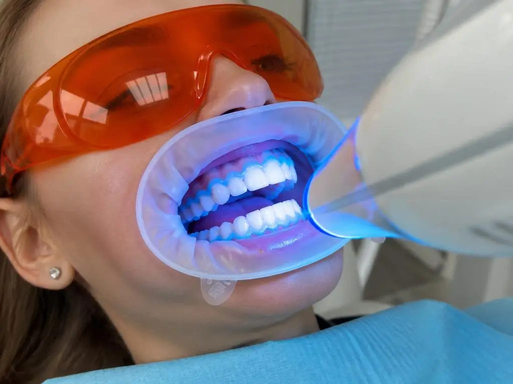 clareamento dental em campo grande ms