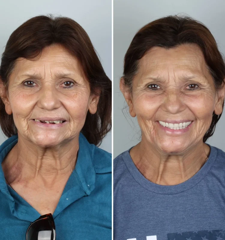 caso-clinico-dentista-campo-grande-ms