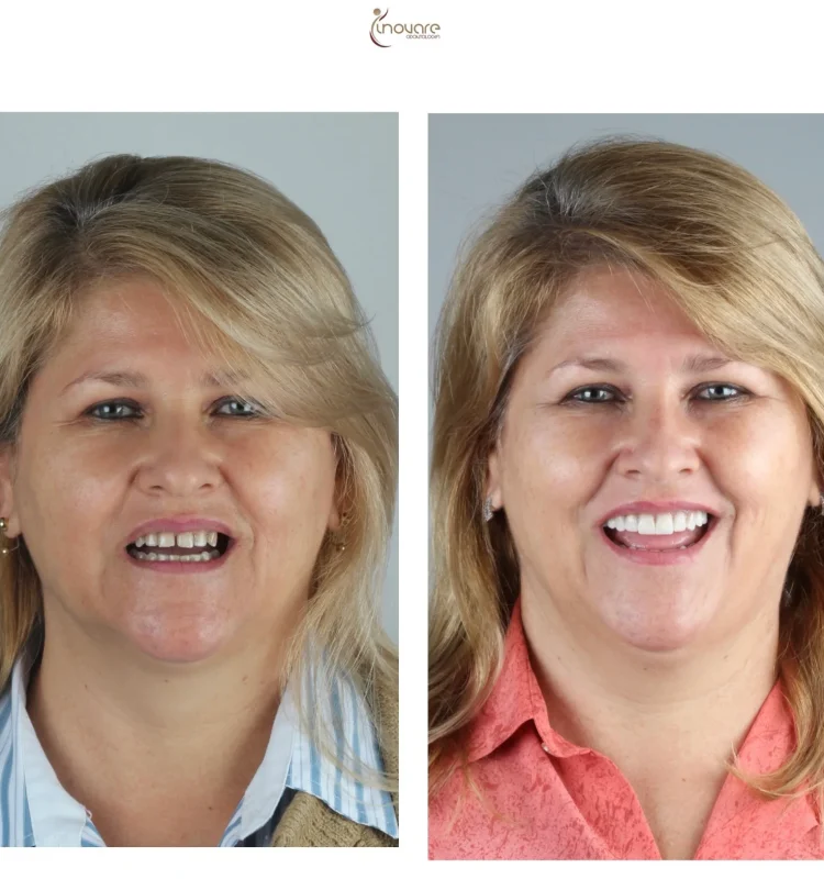 dentista-campo-grande-ms-centro