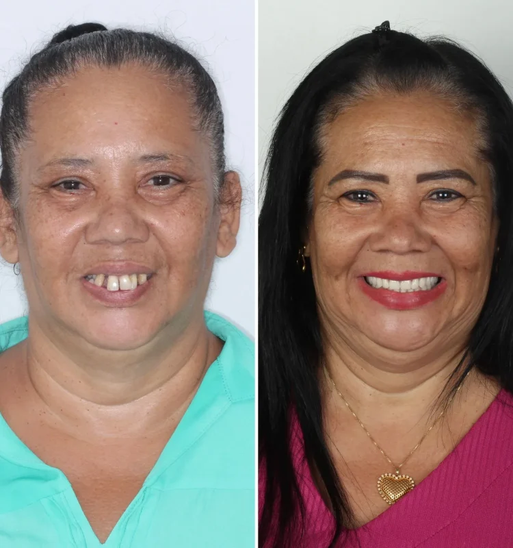 dentista-em-campo-grande-ms