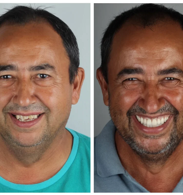 melhor-dentista-de-campo-grande-ms