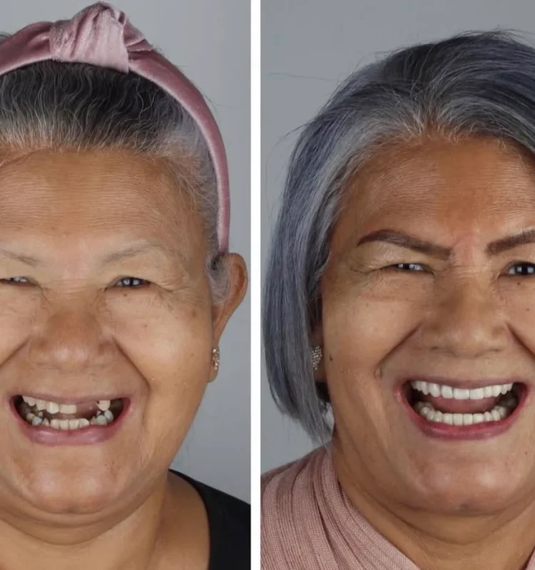 sorriso-novo-dentista-campo-grande-ms