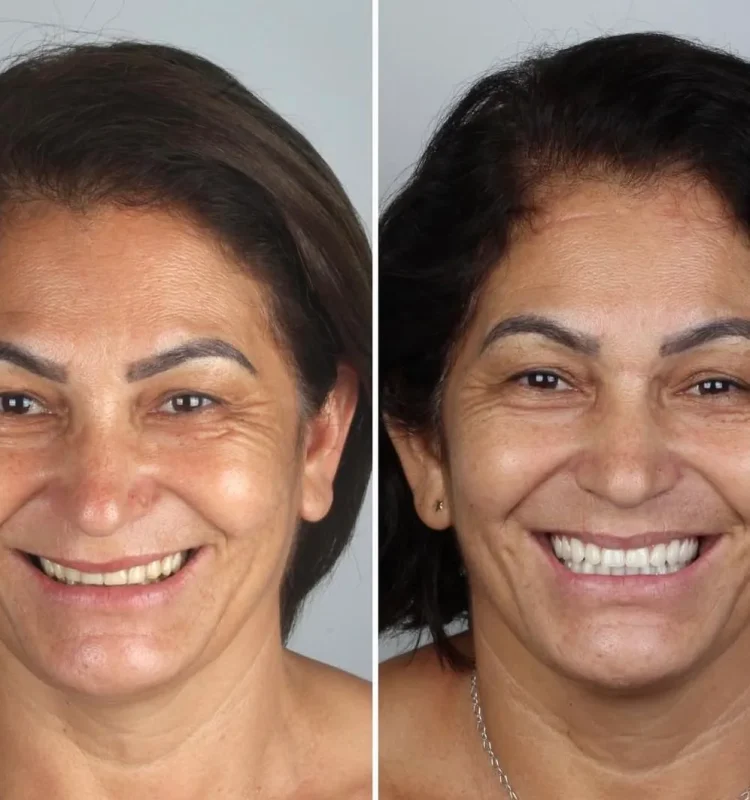 transformacao-do-sorriso-campo-grande-ms